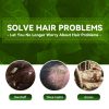 EELHOE Tinea Capitis Anti-Itch Shampoo Anti-Drop Refreshing Oil Control Hair Care Anti-Dandruff Anti-Itch Shampoo
